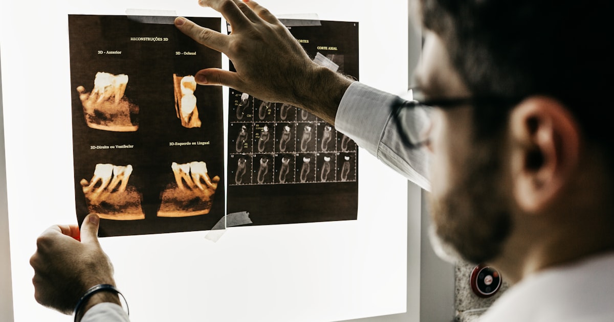 Implante Dentário Para Diabéticos: Riscos, Cuidados e O Que a Ciência Diz